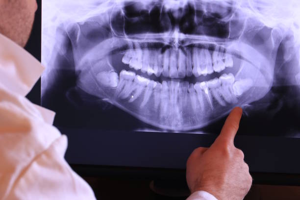 Best Weekend Emergency Dentist in Mulberry, NC