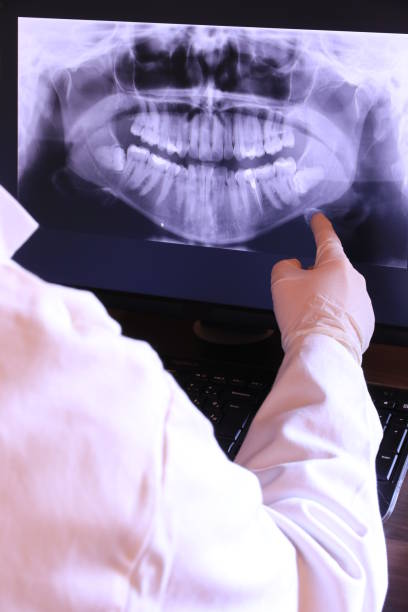 Best Emergency Wisdom Teeth Removal in Mulberry, NC