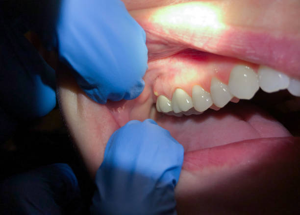 Best Emergency Dental Care for Trauma or Injury in Mulberry, NC